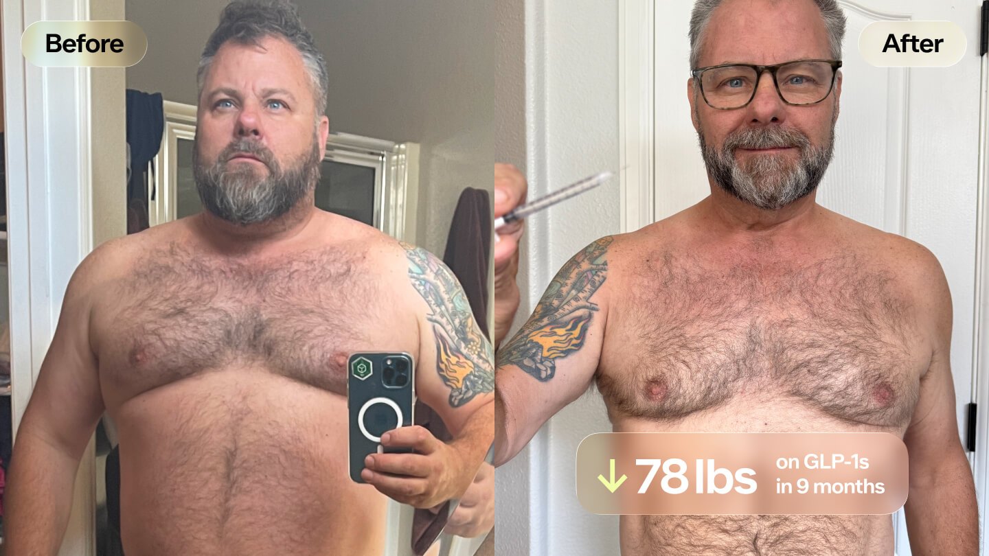 Before-and-after image featuring Greg